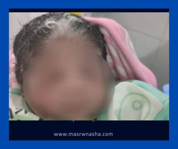 بالصور ولادة نادرة لطفلة بخصلات شعر بيضاء في الرأس بالاقصر