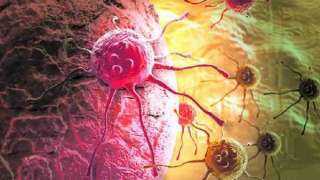 اكتشاف علاج للقضاء على السرطان بتمزيق خلايا تكوينه